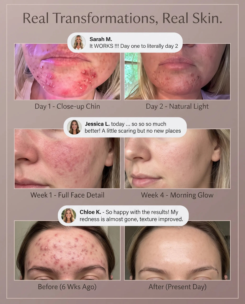 Dunae Photon Arch Clinical Skin Repair and Glow System
