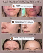Dunae Photon Arch Clinical Skin Repair and Glow System