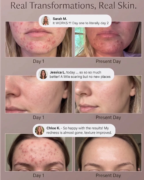 Dunae Photon Arch Clinical Skin Repair and Glow System